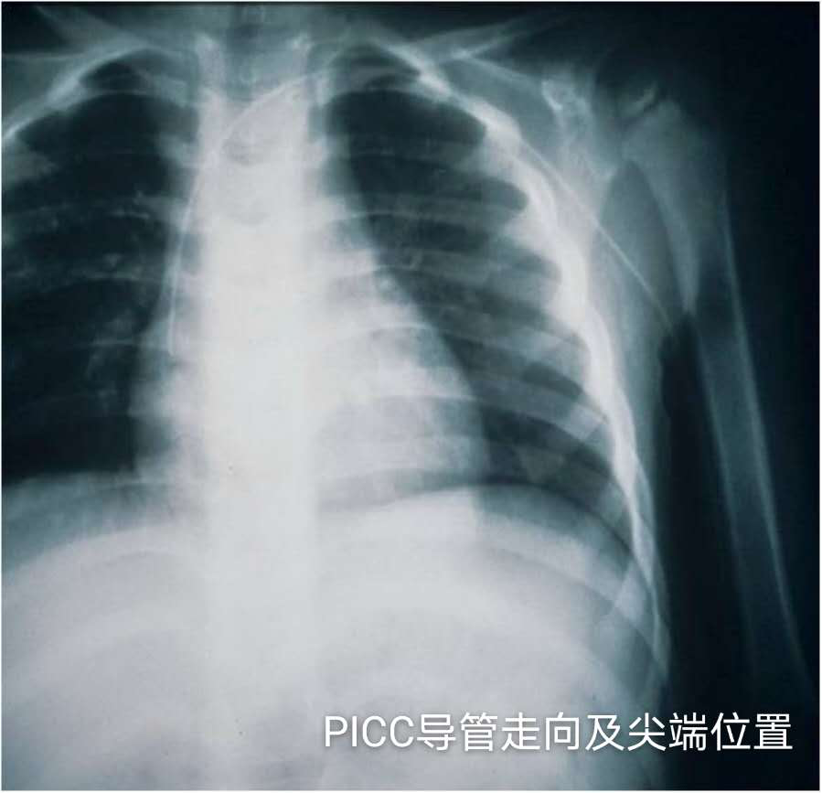 微信圖片_20200320221103_副本.png